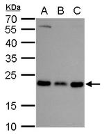 RAB6A Antibody in Western Blot (WB)