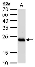 RAB6A Antibody in Western Blot (WB)