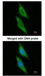 AIP Antibody in Immunocytochemistry (ICC/IF)