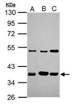 AIP Antibody in Western Blot (WB)