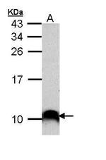 COX7B2 Antibody in Western Blot (WB)