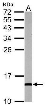 NDUFA5 Antibody in Western Blot (WB)