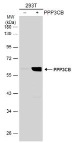 PPP3CB Antibody in Western Blot (WB)