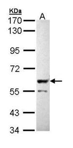 PPP3CB Antibody in Western Blot (WB)