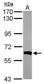 PPP3CB Antibody in Western Blot (WB)