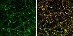 UNC13B Antibody in Immunocytochemistry (ICC/IF)