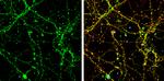 UNC13B Antibody in Immunocytochemistry (ICC/IF)