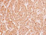 UNC13B Antibody in Immunohistochemistry (Paraffin) (IHC (P))