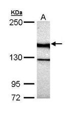 UNC13B Antibody in Western Blot (WB)