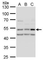 CaMKII delta Antibody in Western Blot (WB)