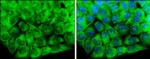 CaMKII delta Antibody in Immunocytochemistry (ICC/IF)