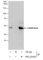 CaMKII delta Antibody in Immunoprecipitation (IP)