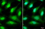 ULK2 Antibody in Immunocytochemistry (ICC/IF)