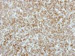 EEF2K Antibody in Immunohistochemistry (Paraffin) (IHC (P))