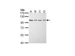 EEF2K Antibody in Western Blot (WB)