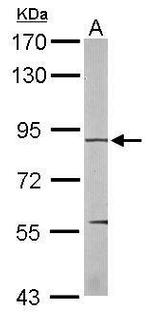 EEF2K Antibody in Western Blot (WB)