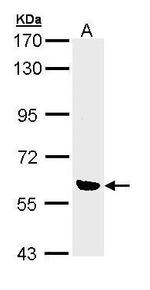 OXSR1 Antibody in Western Blot (WB)