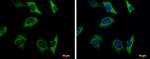 PKLR Antibody in Immunocytochemistry (ICC/IF)