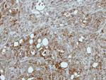 PKLR Antibody in Immunohistochemistry (Paraffin) (IHC (P))