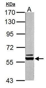 PKLR Antibody in Western Blot (WB)