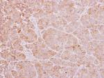 CHP1 Antibody in Immunohistochemistry (Paraffin) (IHC (P))