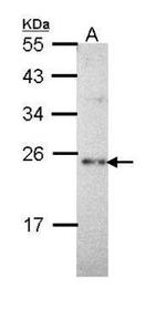 CHP1 Antibody in Western Blot (WB)