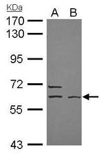 ELP3 Antibody in Western Blot (WB)