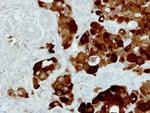 PIG3 Antibody in Immunohistochemistry (Paraffin) (IHC (P))