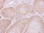 PECR Antibody in Immunohistochemistry (Paraffin) (IHC (P))