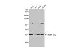 TCP-1 beta Antibody in Western Blot (WB)