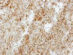 GMDS Antibody in Immunohistochemistry (Paraffin) (IHC (P))