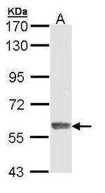 IFIT3 Antibody in Western Blot (WB)