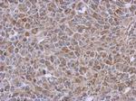 DLST Antibody in Immunohistochemistry (Paraffin) (IHC (P))