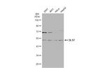 DLST Antibody in Western Blot (WB)