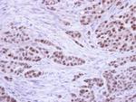 RPA2 Antibody in Immunohistochemistry (Paraffin) (IHC (P))