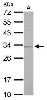 RPA2 Antibody in Western Blot (WB)