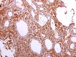 VCP Antibody in Immunohistochemistry (Paraffin) (IHC (P))