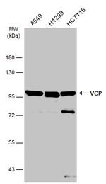 VCP Antibody in Western Blot (WB)