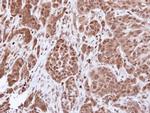 alpha Actinin 4 Antibody in Immunohistochemistry (Paraffin) (IHC (P))