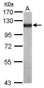 alpha Actinin 4 Antibody in Western Blot (WB)