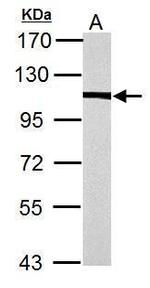 alpha Actinin 4 Antibody in Western Blot (WB)