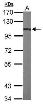 alpha Actinin 4 Antibody in Western Blot (WB)