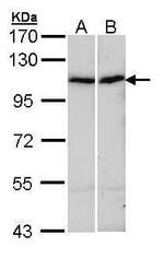 alpha Actinin 4 Antibody in Western Blot (WB)