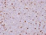 RACGAP1 Antibody in Immunohistochemistry (Paraffin) (IHC (P))