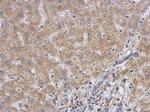 RACGAP1 Antibody in Immunohistochemistry (Paraffin) (IHC (P))