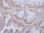 MST3 Antibody in Immunohistochemistry (Paraffin) (IHC (P))