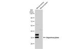 Aspartoacylase Antibody in Western Blot (WB)