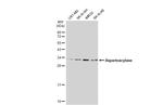 Aspartoacylase Antibody in Western Blot (WB)