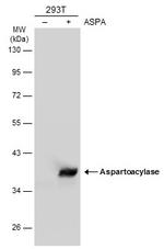 Aspartoacylase Antibody in Western Blot (WB)