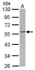 FKBP4 Antibody in Western Blot (WB)